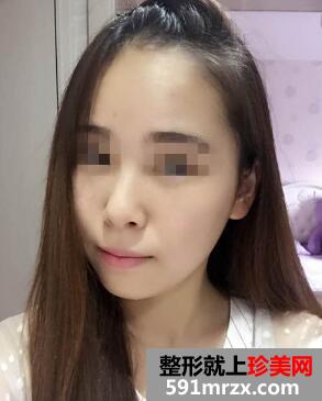 �qԥ�˴����K�����˃�(n��i)��ȥ�۴� һ���۴��Ͳ�Ҋ��