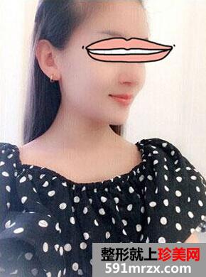 ����ޱ�������t(y��)Ժ�nʽmisko¡�Ǻ� ���|(zh��)˲�g�j��
