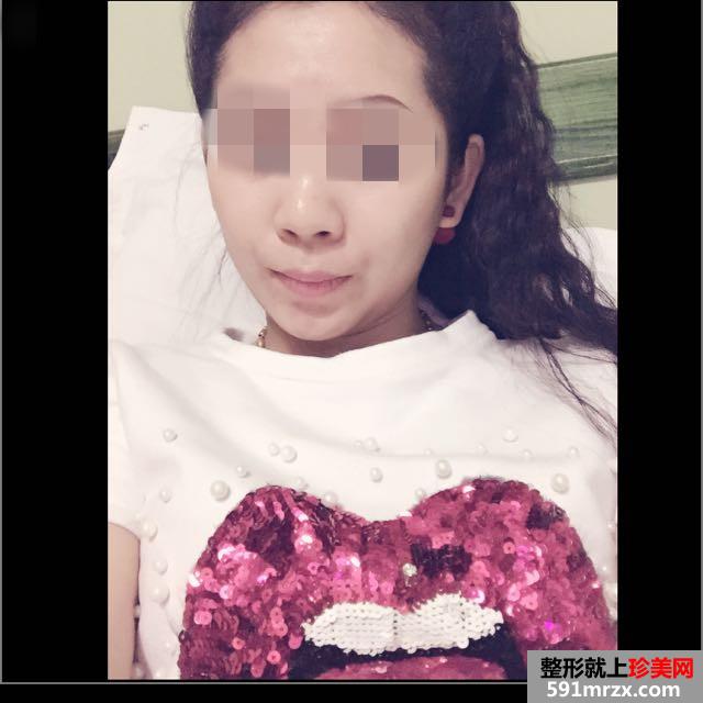 ��(n��i)�Q�R�沿�����g(sh��)ǰ��(du��)��Ч���DƬ�ͻ֏�(f��)�^��