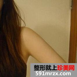ˮ��(d��ng)����֬���ֱ۰���Ч���D