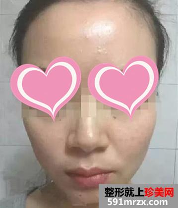 ���ݺ�ƽ�����t(y��)Ժ��ˮ��ᘺ� ׌70��Ů���I(l��ng)�n�w���g