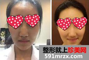 ���ݼ������������t(y��)Ժˮ��ע��� ����ϰ�Ҳ���o����