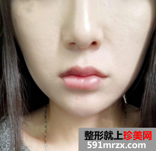 һ֧�������S��Ч���D �������挍(sh��)�Ľ�(j��ng)�v