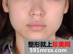 ˮ���Ч���Dǰ�󌦱� ��e���?z��i)? height=