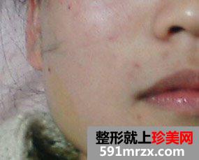 ˮ���Ч���Dǰ�󌦱� ��e���?z��i)? height=
