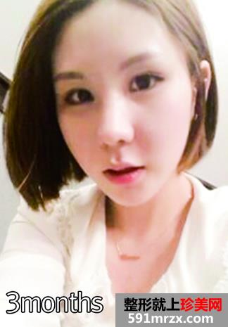 �ű������p��Ƥ���g(sh��)�Ļ֏�(f��)�^�̷���