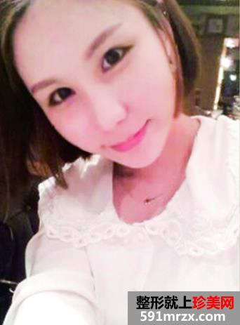 �ű������p��Ƥ���g(sh��)�Ļ֏�(f��)�^�̷���