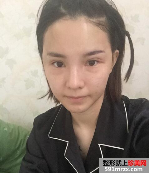 ̫�Ѩ�~�^֬����䣬��ɻ�Ѫ�L(f��ng)͑׃��ԊW(w��ng)��