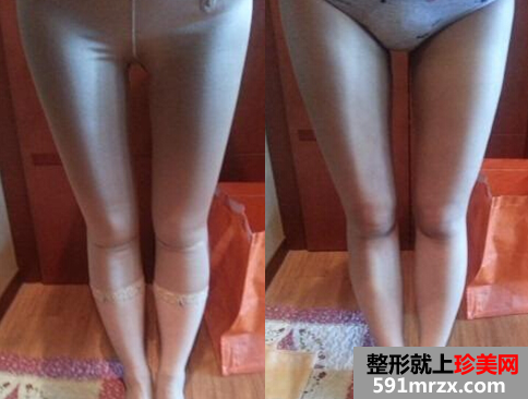 �Ȳ���֬+���w֬���S�����g��֏ͽ��v