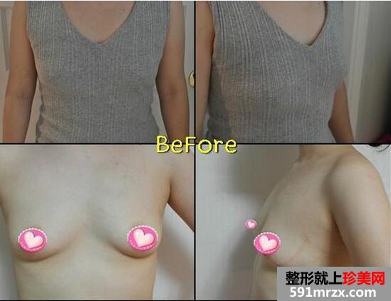 ���¼��w¡���g(sh��)���挍���팦�ȈD