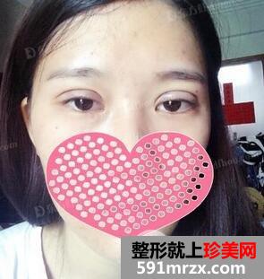 ȫ���p��Ƥ8mm���Ĵ�ƽ�����˰����֏�(f��)�DƬ