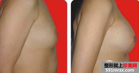 �ȸQ�R���w¡����Ҫ�����X �ȸQ�R¡�����g��Ч���D