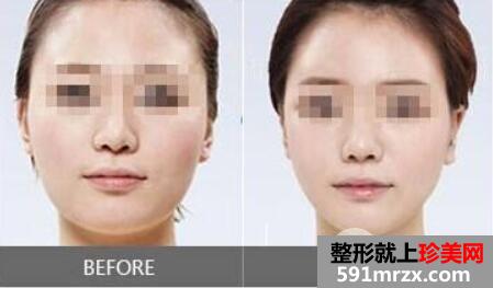 Ę��֬һ������X �沿��֬�������g(sh��)��ע�����(xi��ng)