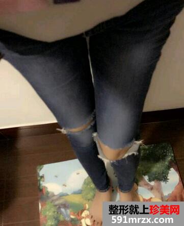 ������֬ǰ�󌦱���Ƭ ������֬�֏�ӛ�
