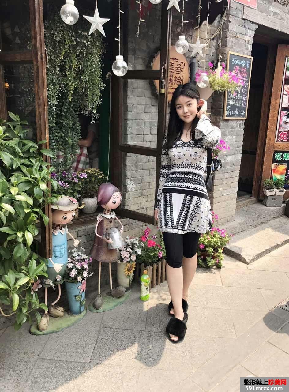 ��֬���ֱ�+�沿��֬�H����(j��ng)�v�ЈD�����࣬��(du��)����֬���f(shu��)�ݰ�