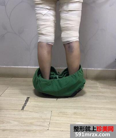 ˮ������֬�ݴ��ȃr�������֬�挍�������ȈD