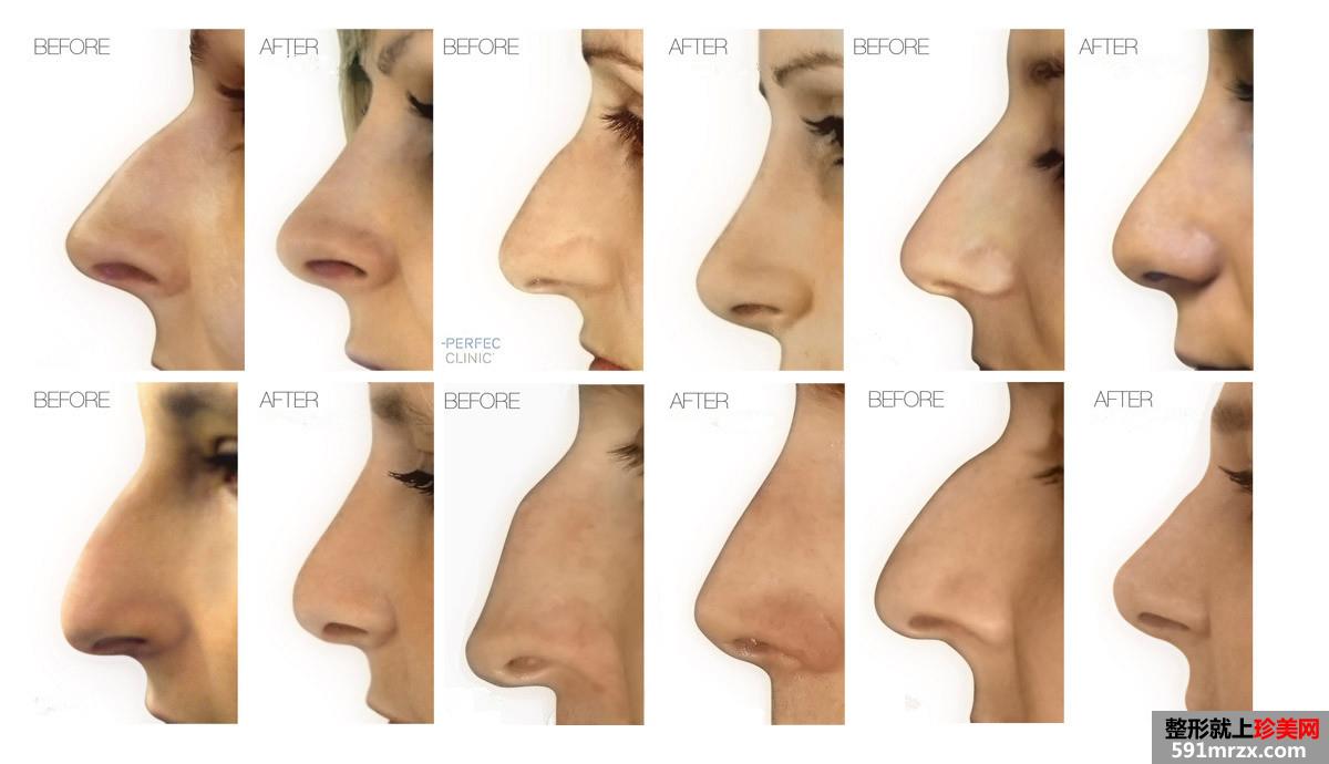 ��h٤�������tԺȫ�r����Ͼ�