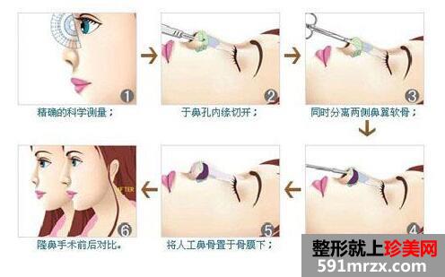 ��h��ʢ�����tԺ���r����Ͼ�