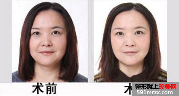 �Ϻ���(li��n)���t(y��)Ժ��Ҏ(gu��)�᣿���΃r��������w������˥������ǰ�󌦱ȈD