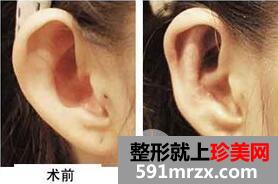 ���L���������g�����X?�C��Ч���D