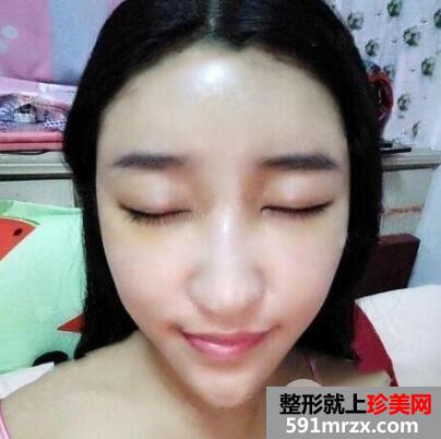 ���A�������t(y��)Ժ���˵ڶ������w֬���沿���Ч���ܺ�