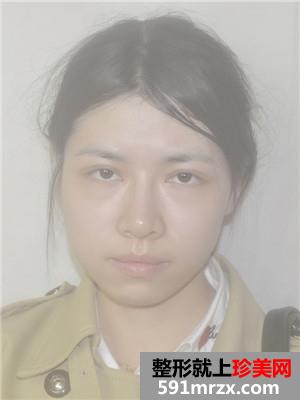 ���z���w�|�°ͻ֏���r������ǰ�󌦱���Ƭ