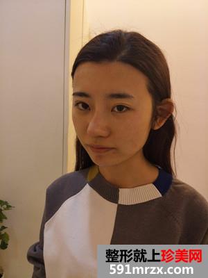 С��������坍+�״������g(sh��)��Ч���DƬ����