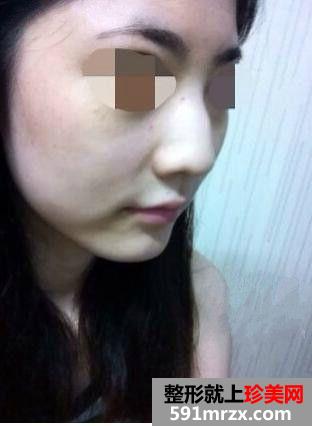 ��ǳC���g(sh��)ǰ��(du��)���պͻ֏�(f��)�^(gu��)��ӛ�