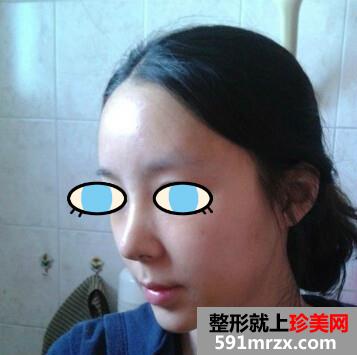 ¡���g(sh��)���˰���Ч���D