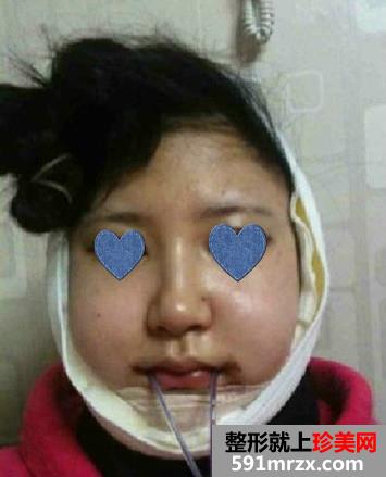 �����˰������킀180�����D(zhu��n)׃��������˼׌���wĽ���ʺ��ˣ�