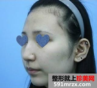 �����˰������킀180�����D(zhu��n)׃��������˼׌���wĽ���ʺ��ˣ�