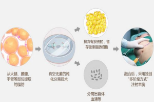 ���w֬���S�����g�ܚgӭ��ԭ����ʲô?