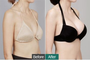 ���w֬���S�����g�ܚgӭ��ԭ����ʲô?