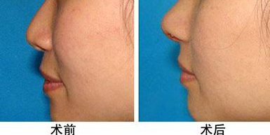 �����z¡���ļ��t(y��)Ժ���ú�