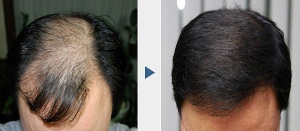 FUE�Nֲ�^�l(f��)��Σ��