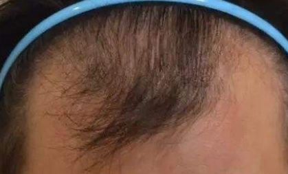 FUT�Nֲ�^�l(f��)���Y(ji��)���