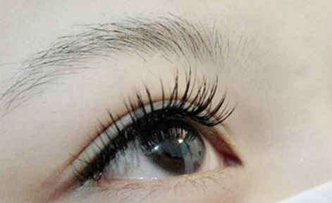 ʧ�ߵ��������p��Ƥ��?