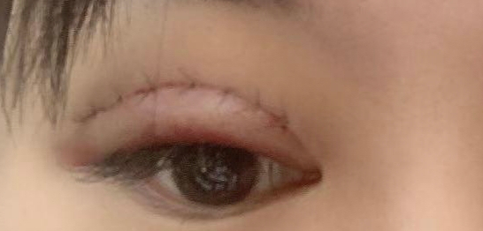 ���p��Ƥ���p��Ƥ���gҪ�񾀆�