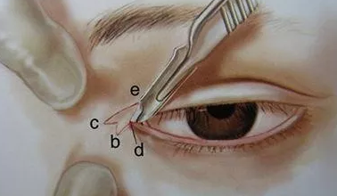 �p��Ƥ��ô���