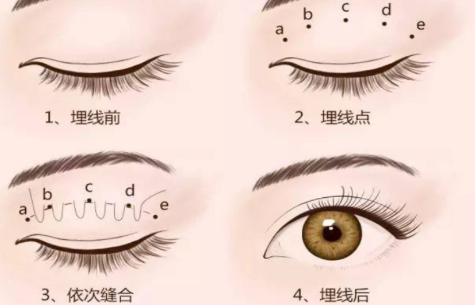 �p��Ƥ����ʲôΣ��