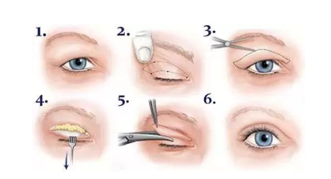 �p��Ƥ���g����