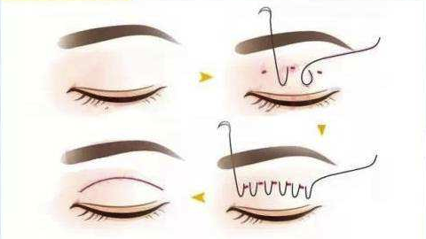 ����Ƥ׃�p��Ƥ���g����