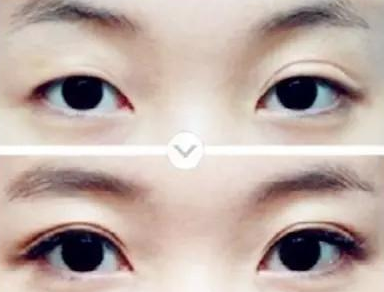 �_���۽����g��ÿ��Ի֏���Ȼ?