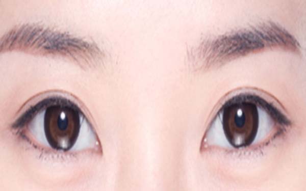 �nʽ�o���_�۽����g����