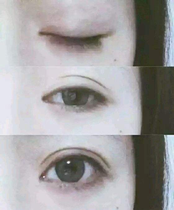 ����۽���ʲôΣ��