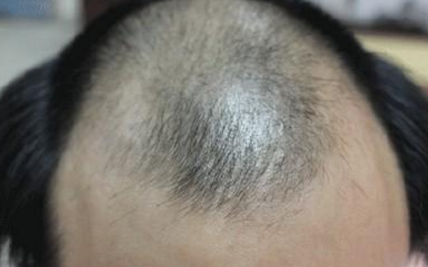 FUEֲ�l���g�ă��c����