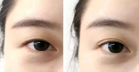 ���p��Ƥһ��r�����