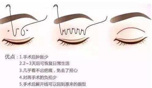 ���p��Ƥ�������Æ�