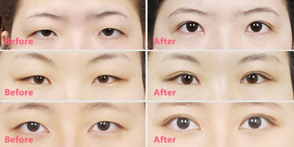 ΢�����c�p��Ƥ�֏͈D