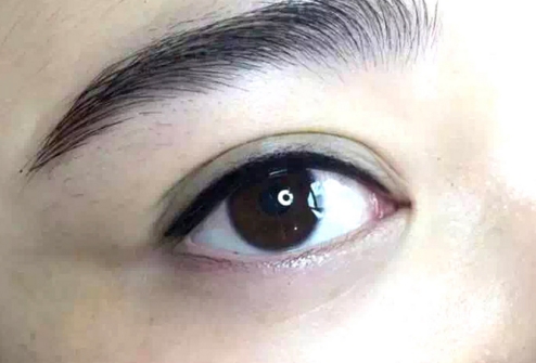 �Ϸ�΢���p��Ƥ���g��ȫ��